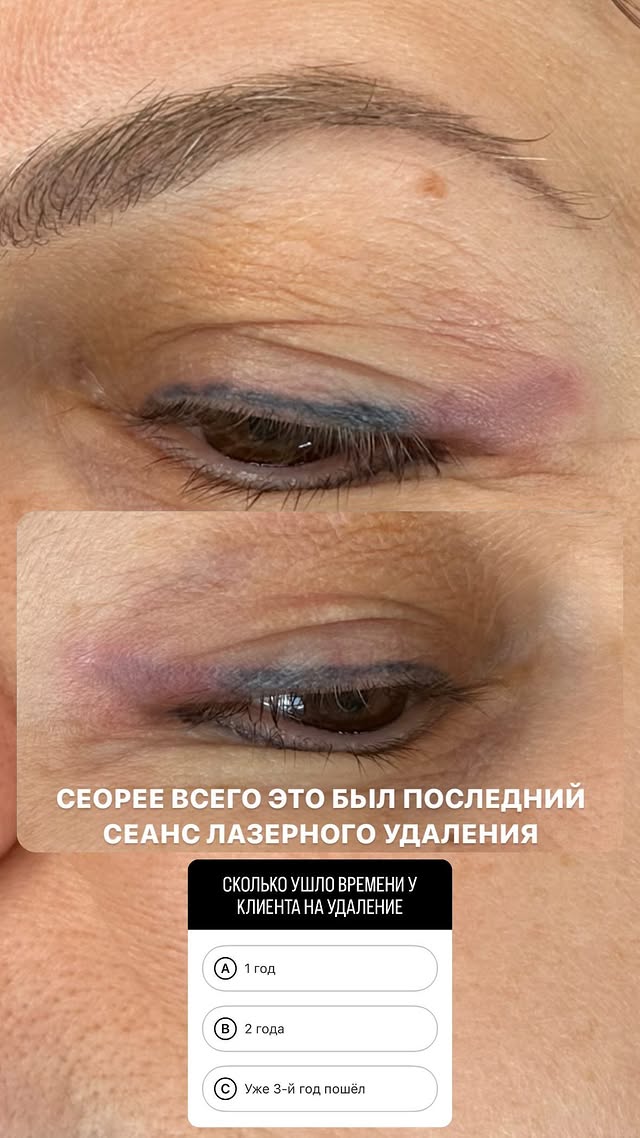 Стрелки и межресничка